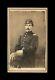 Cdv Of Civil War Soldier Probably 75th Ny Infantry Possible Id & Pow / Wia