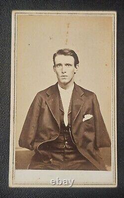 Pair of CDVs US Civil War Sgt. Alfred A. Stratton 147th NY Inf Double Amputee