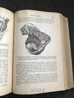 Rare 1887 1st Edition Text Book on Surgery John A. Wyeth M. D. Civil War Surgeon