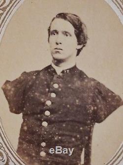 Union Civil War Soldier Alfred Stratton 2x Amputee 147th NY Inf CDV Image